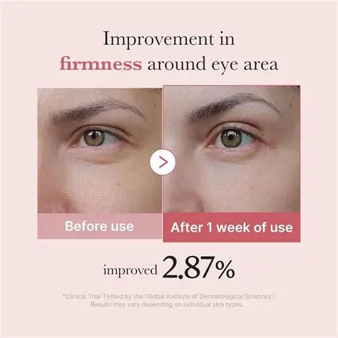 Medicube – PDRN Pink Peptide Eye Cream – 30ml