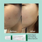 AXIS-Y – Dark Spot Correcting Glow Serum, 50ml